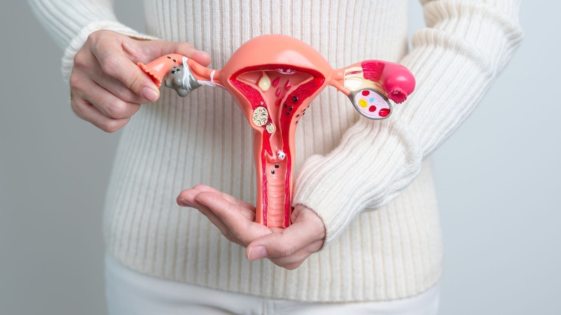 Endométriose et naturopathie : comprendre, aider à soulager et rééquilibrer naturellement