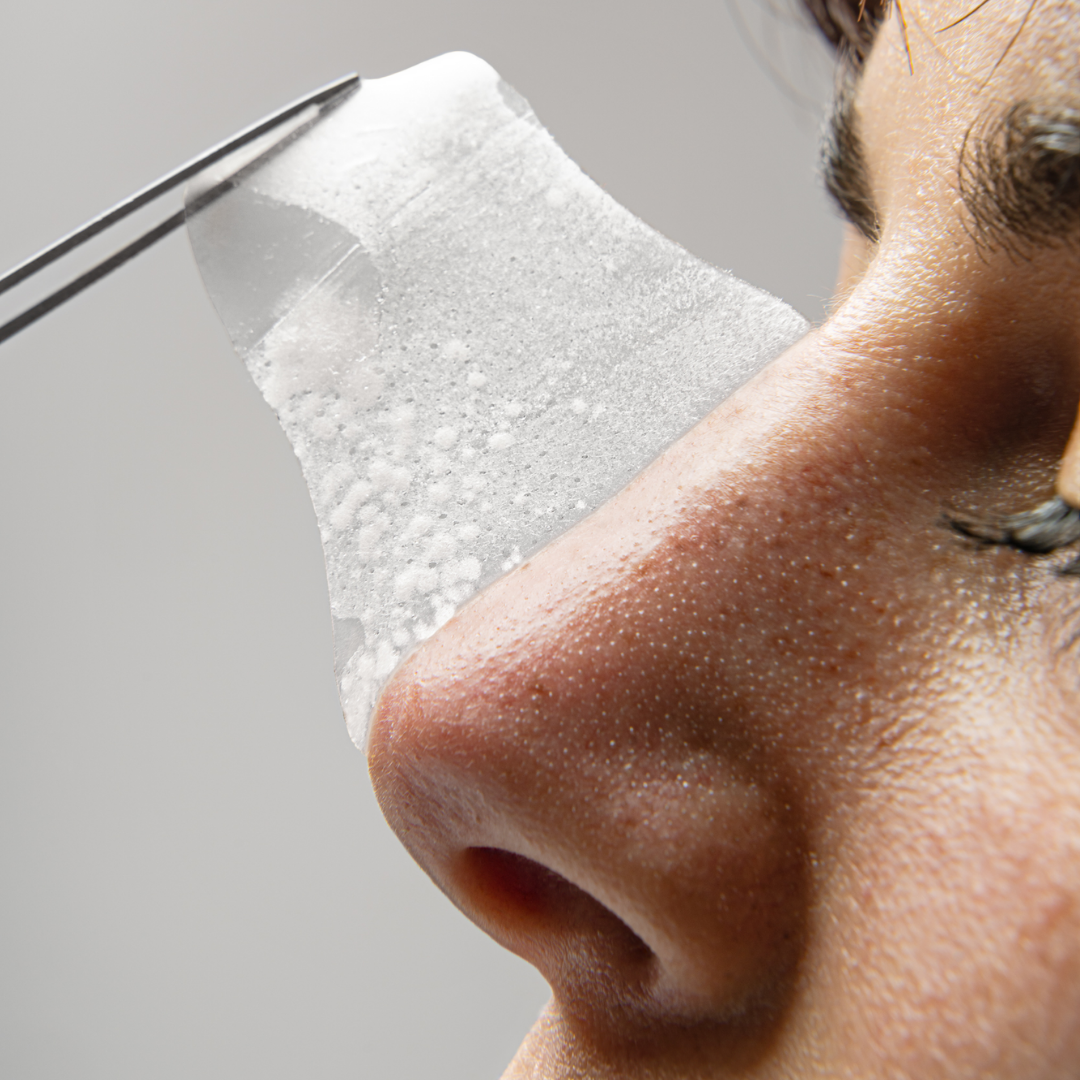 PATCHS NEZ POINTS NOIRS HYDROCOLLOÏDE - POINTS NOIRS