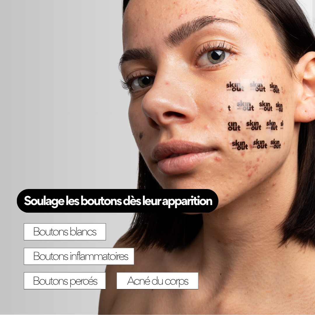 PATCHS BOUTONS XL HYDROCOLLOÏDE - ACNÉ ÉTENDUE