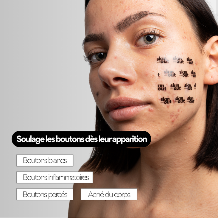 PATCHS BOUTONS XL HYDROCOLLOÏDE - ACNÉ ÉTENDUE - Image 2